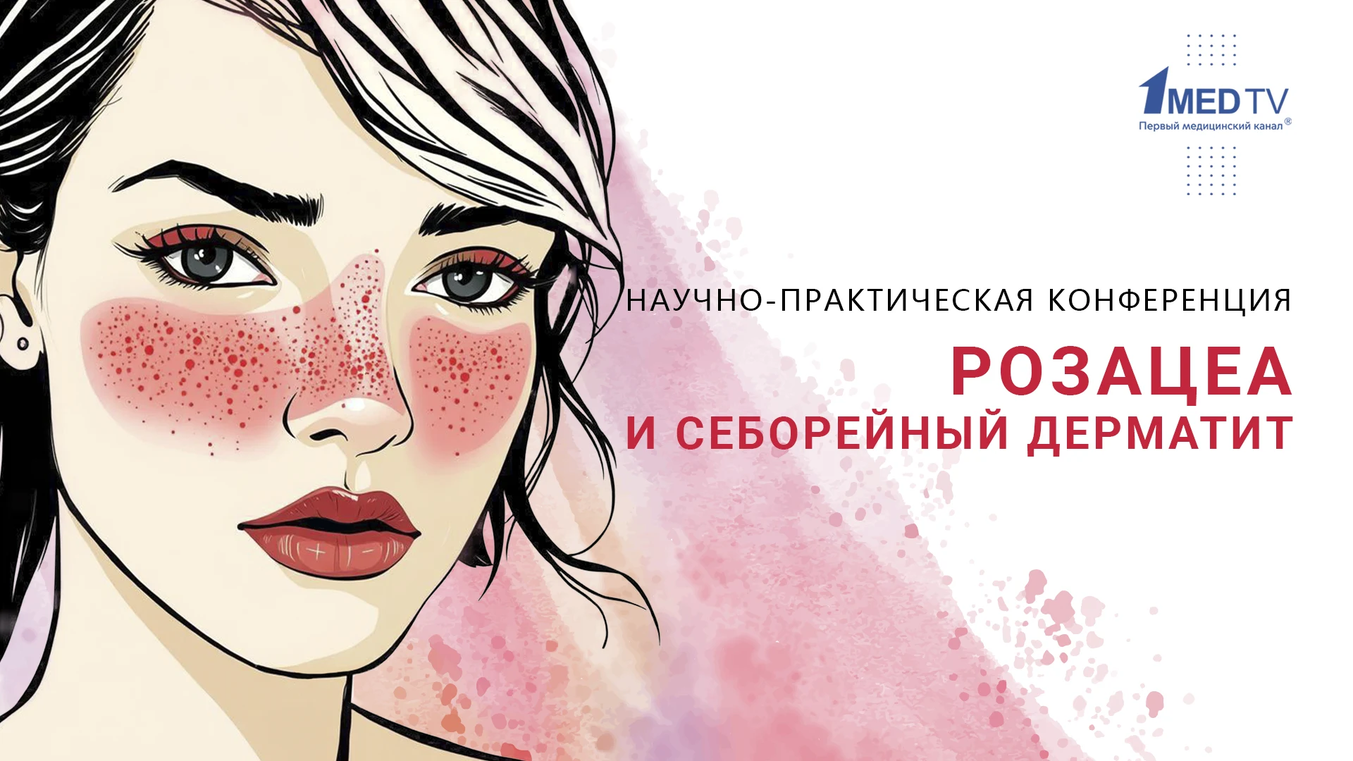 Розацеа и себорейный дерматит