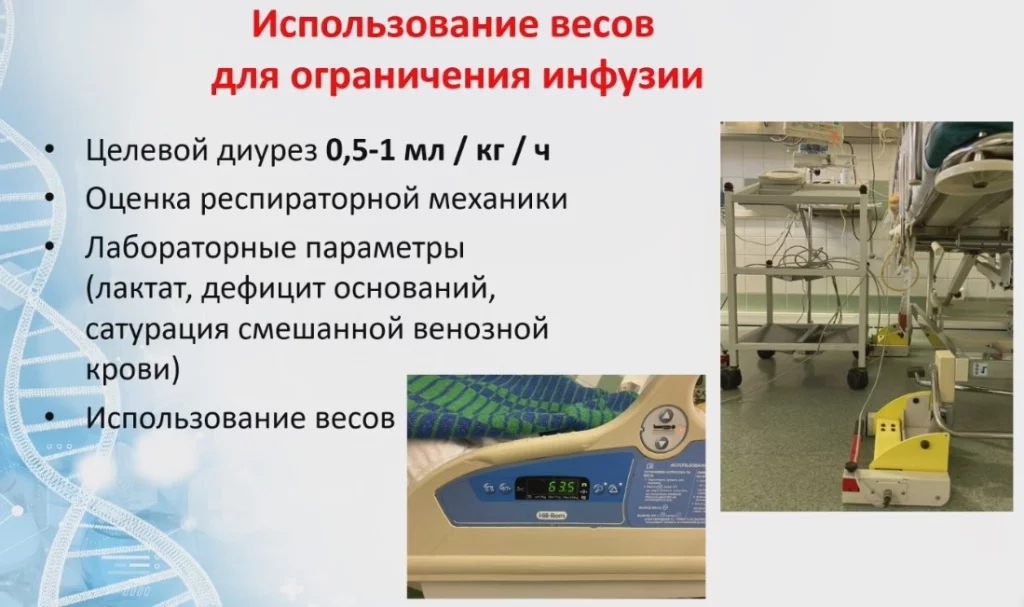 Использование весов для ограничения инфузии.jpg